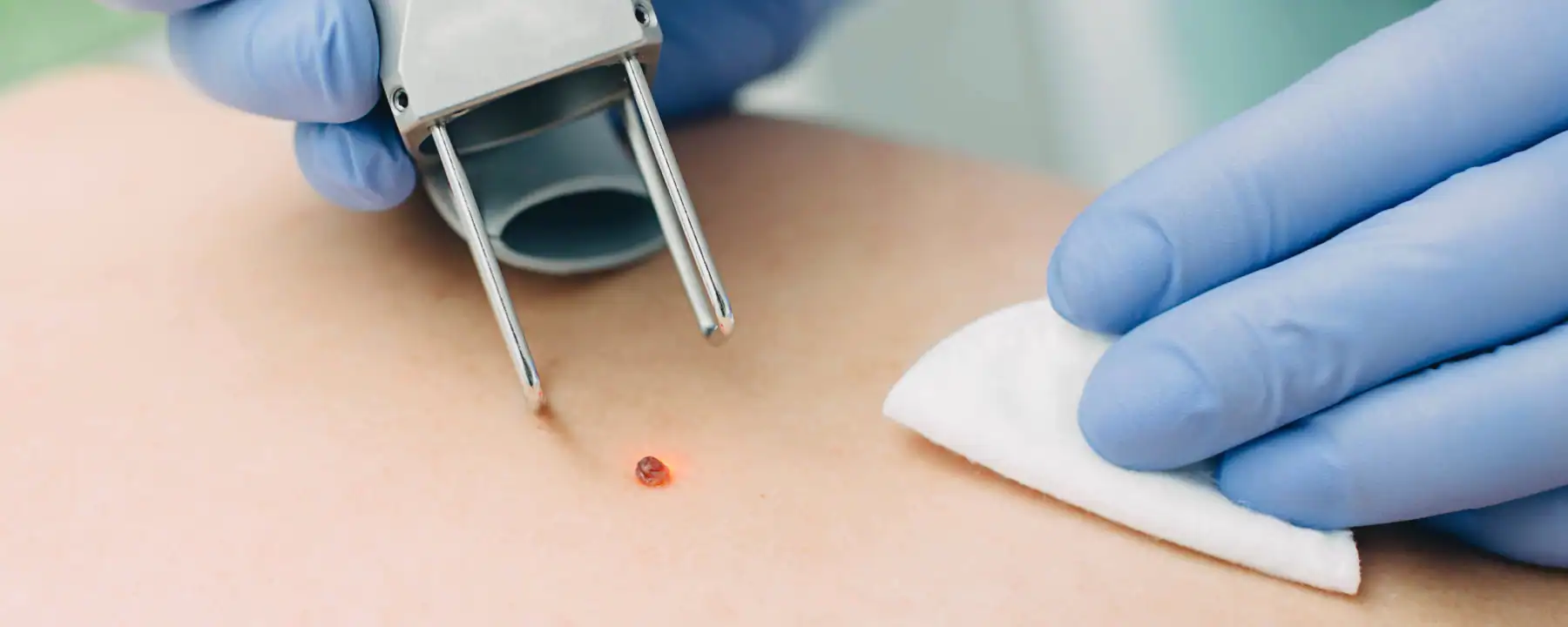 페어리큐라이제미