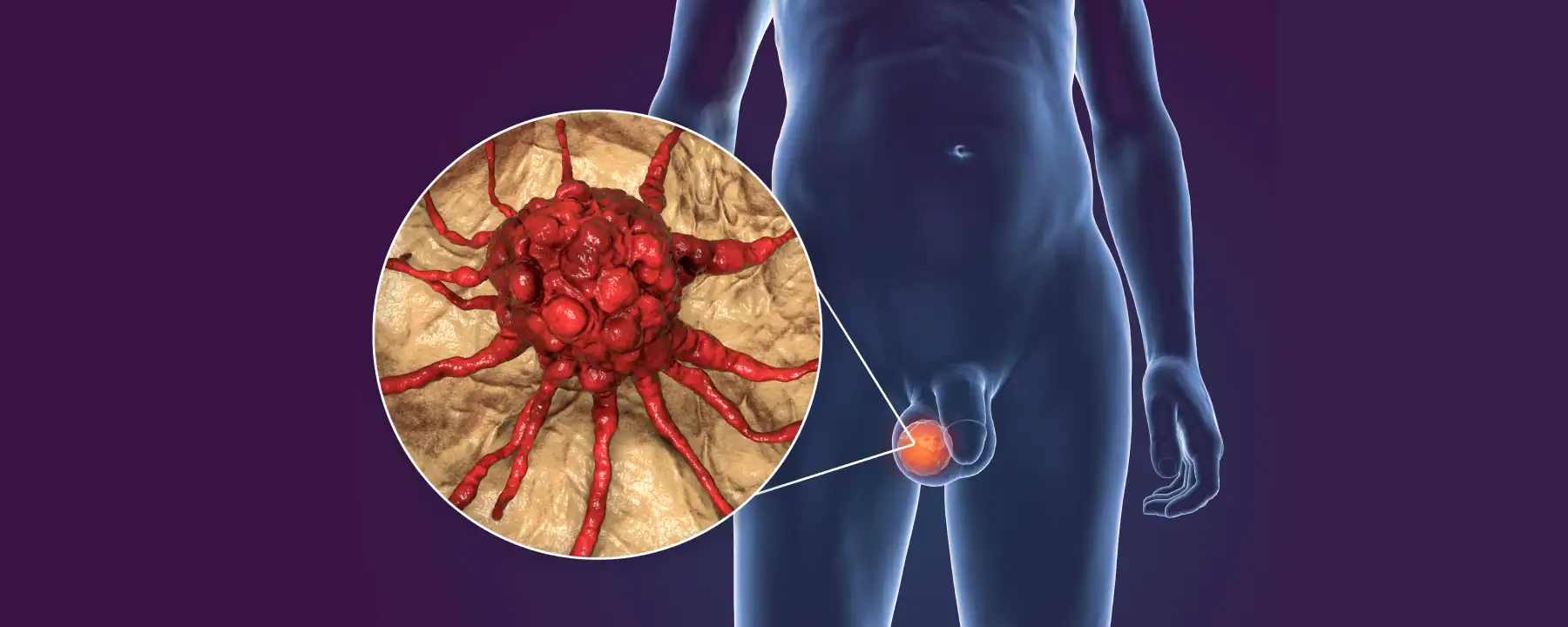 페어리큐라이제미