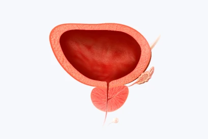 전립선 암 조기 발견