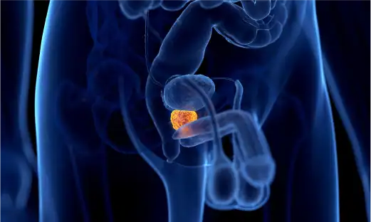 비뇨기과 전문의가 환자의 증상을 파악하고 검사를 진행합니다.