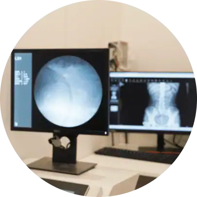 전립선 암 조기 발견