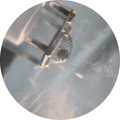 전립선 암 조기 발견