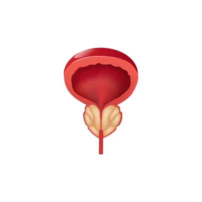 전립선 암 조기 발견