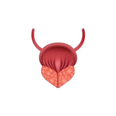 전립선 암 조기 발견