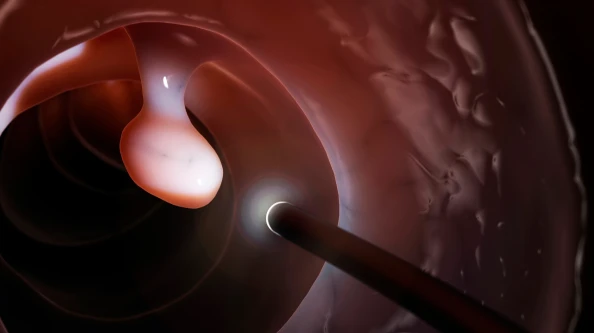 전립선 암 조기 발견