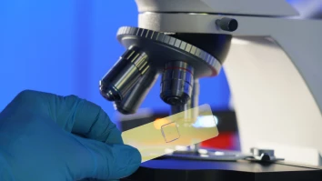 전립선 암 조기 발견