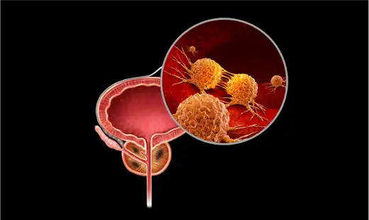 비뇨기과 전문의가 환자의 증상을 파악하고 검사를 진행합니다.