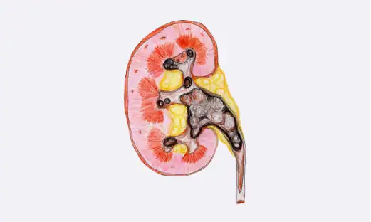 비뇨기과 전문의가 환자의 증상을 파악하고 검사를 진행합니다.